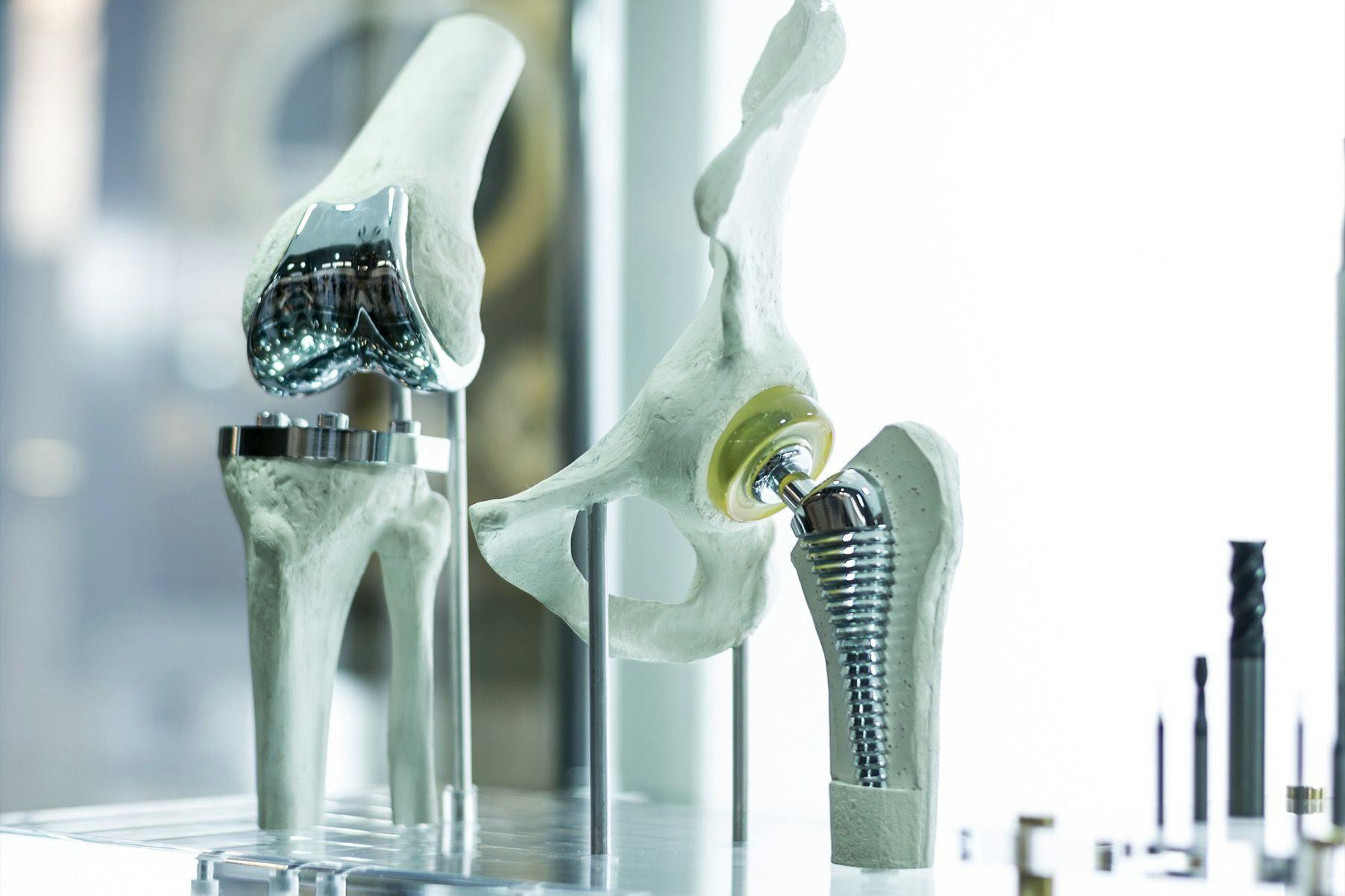 Hip replacement device