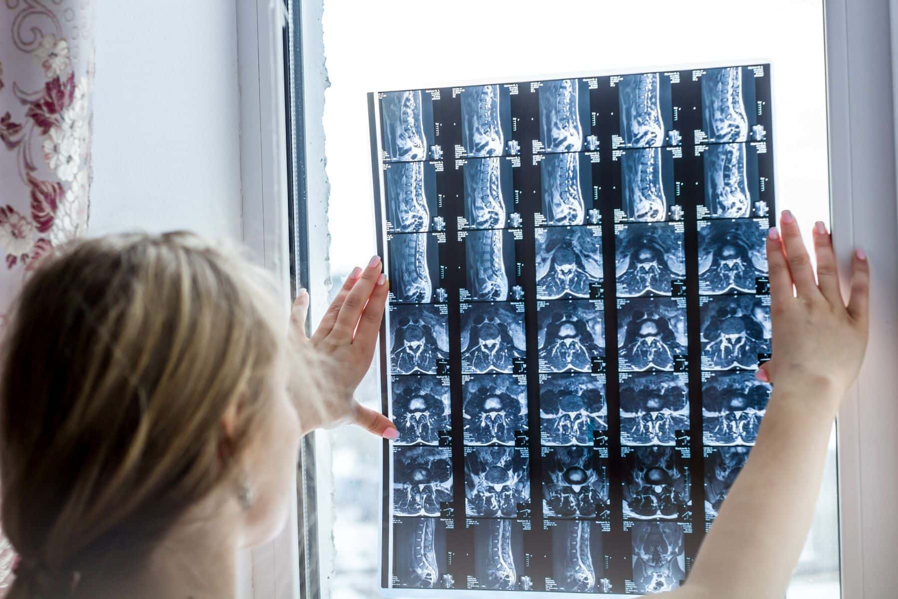 MRI of vertebral section